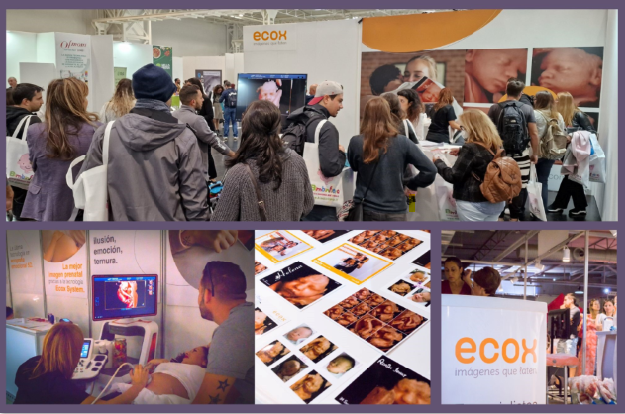 Ecox 5D realiza ecografías emocionales en centros Prenatal