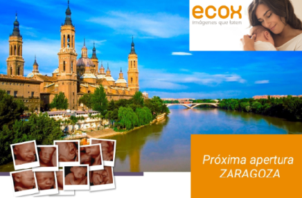 Ecox 5D, ecografía emocional a embarazadas llega a Zaragoza