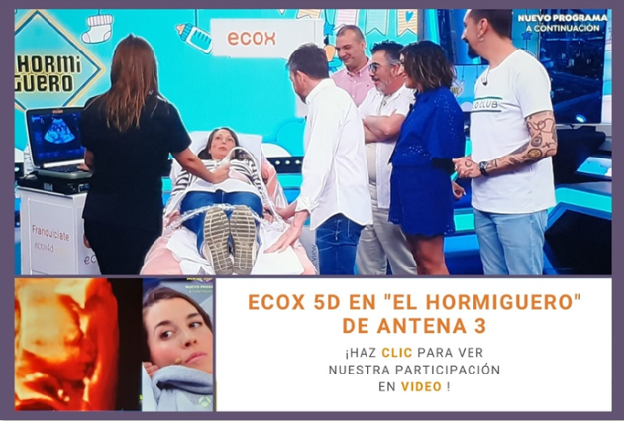 Ecox en el programa prime time de Antena 3, El Hormiguero